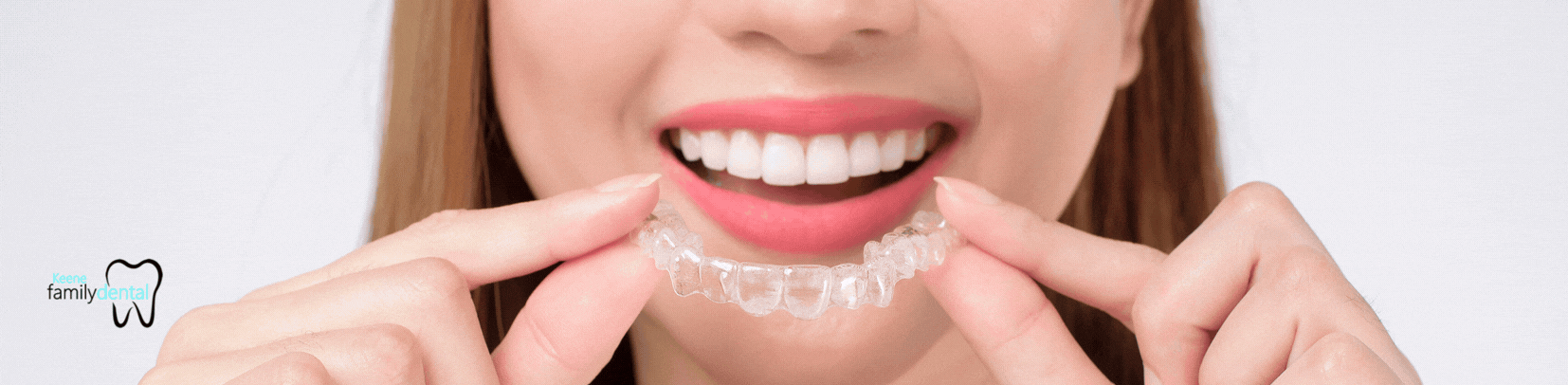 Invisalign Treatment Near Alvarado, TX