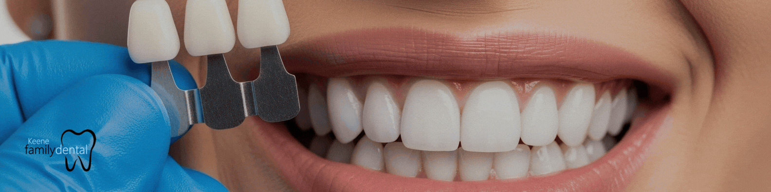 Same-Day Dental Crowns