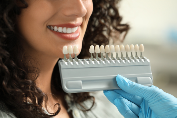 Patient discussing alternatives to dental veneers in Keene, TX