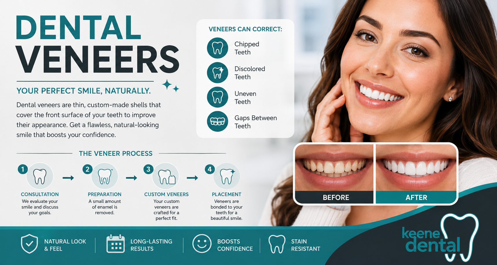 Dental veneers infographic showing the veneer process, candidacy, and benefits at Keene Family Dentistry