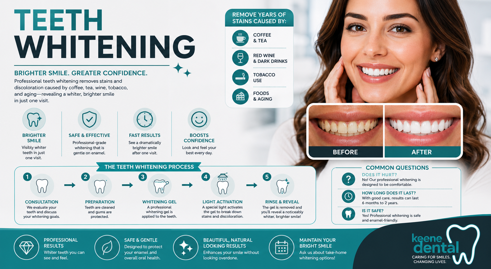 Professional teeth whitening infographic showing the process, benefits, and maintenance at Keene Family Dentistry